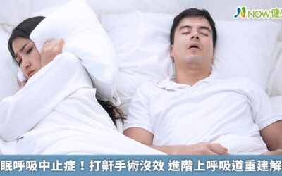 睡眠呼吸中止症！打鼾手術沒效 進階上呼吸道重建解救